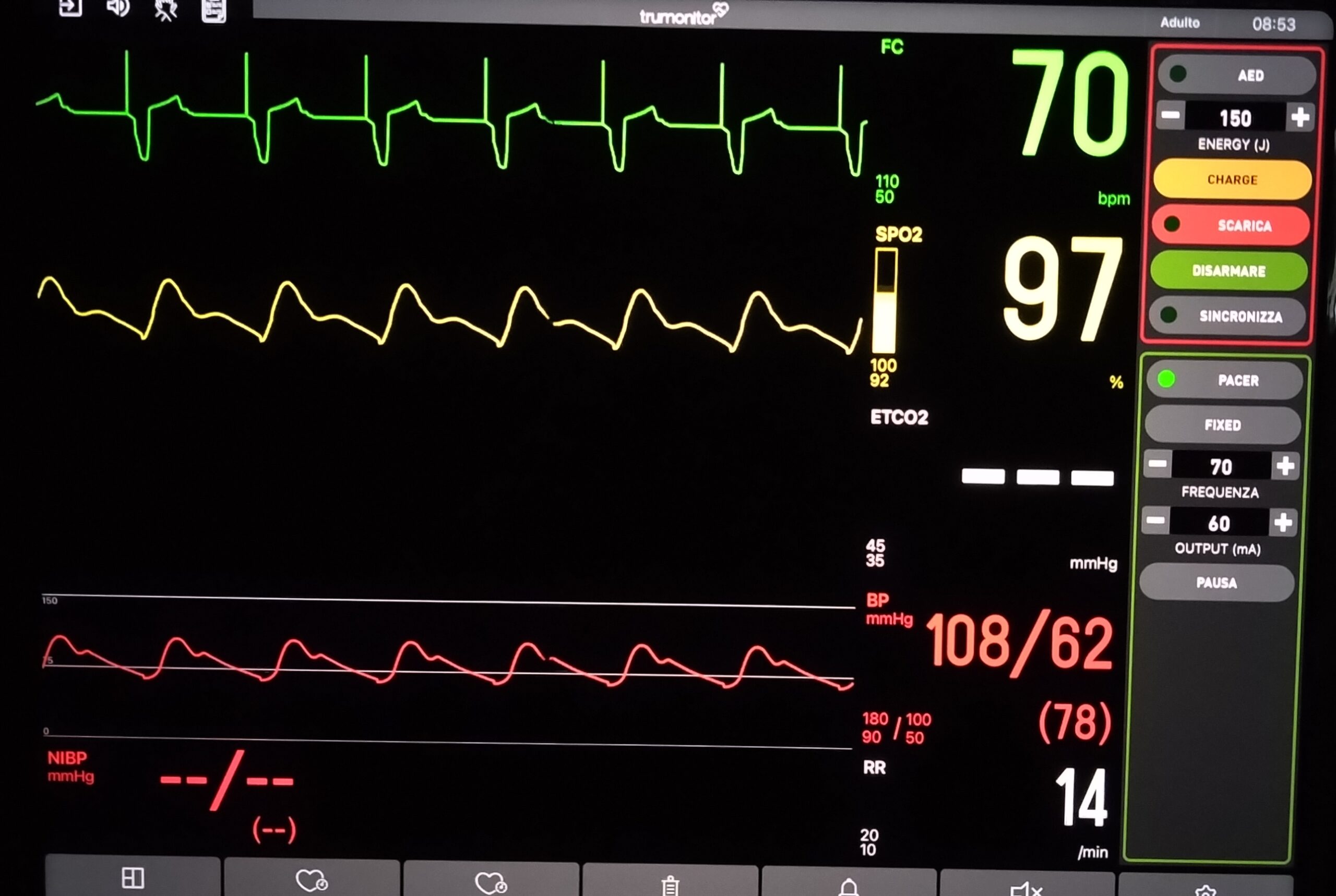 ACLS:pilastro nel soccorso avanzato dell'arresto cardiaco